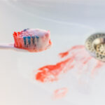 Avoid Gum Disease - Optima Dental Spa