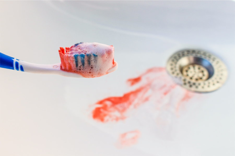 Blood on a toothbrush and in the sink because the patient has gum disease